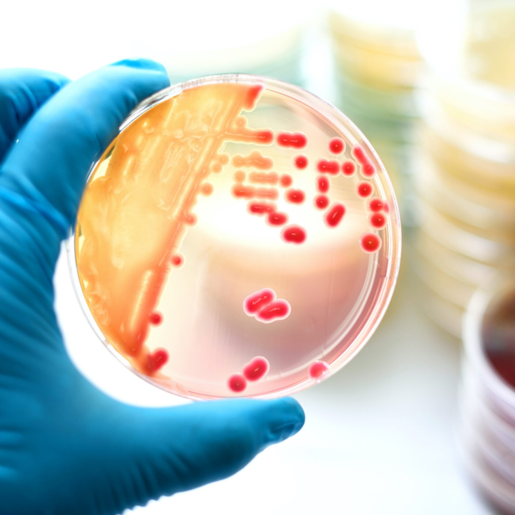 Bakterienkultur in einer Petrischale