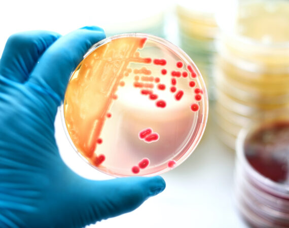 Bakterienkultur in einer Petrischale