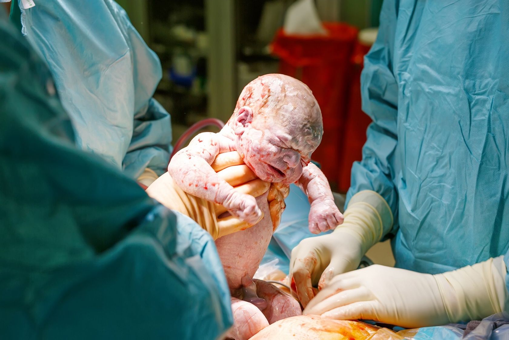 Neugeborener Säugling gleich nach der Entbindung