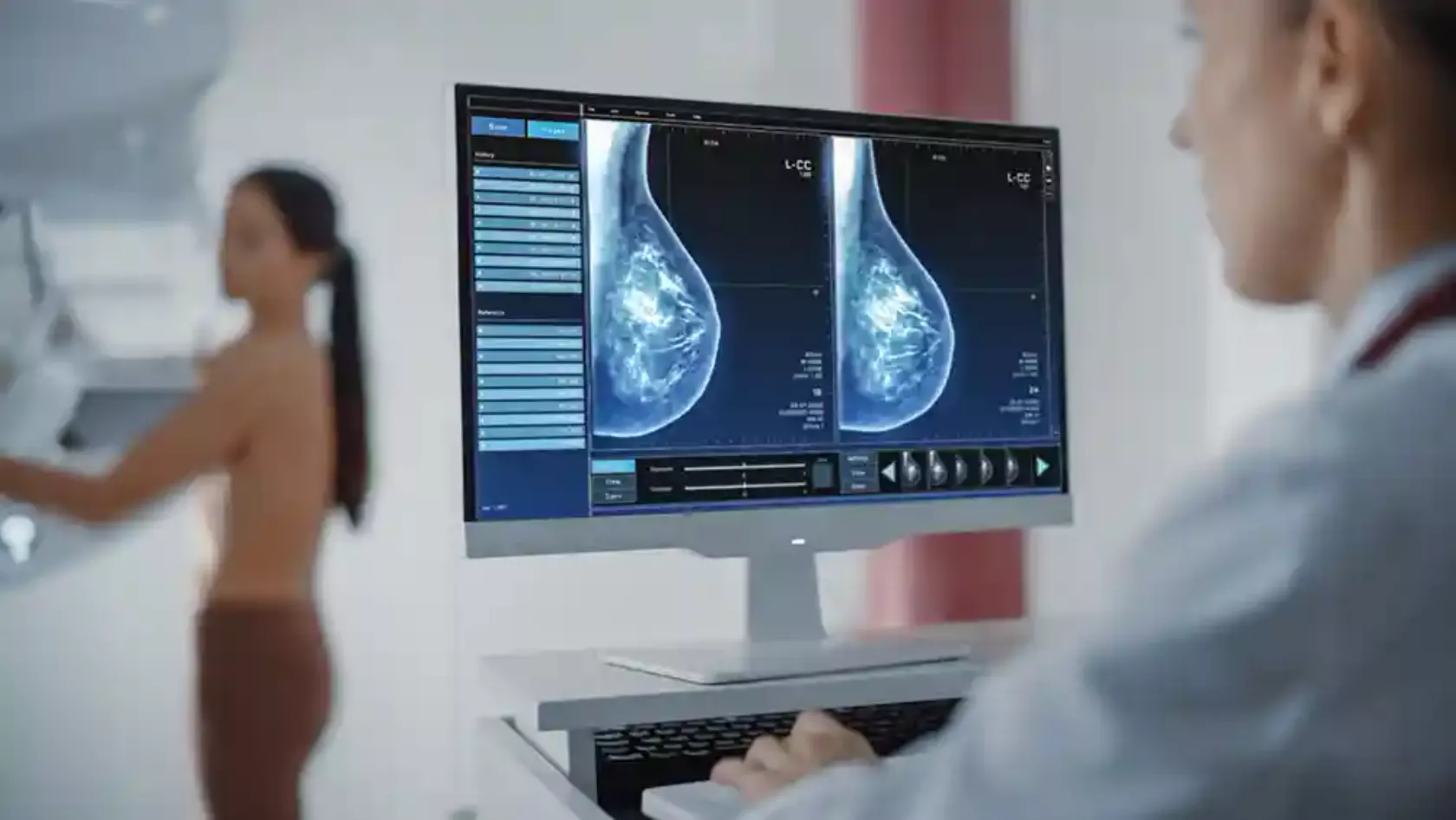 Ärztin betrachtet am Monitor live den Mammographie-Scan einer Patientin.