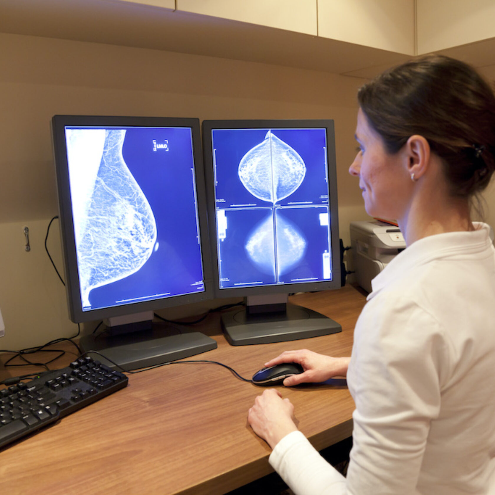 Ärztin betrachtet digitale Aufnahme von Brustkrebs am Monitor