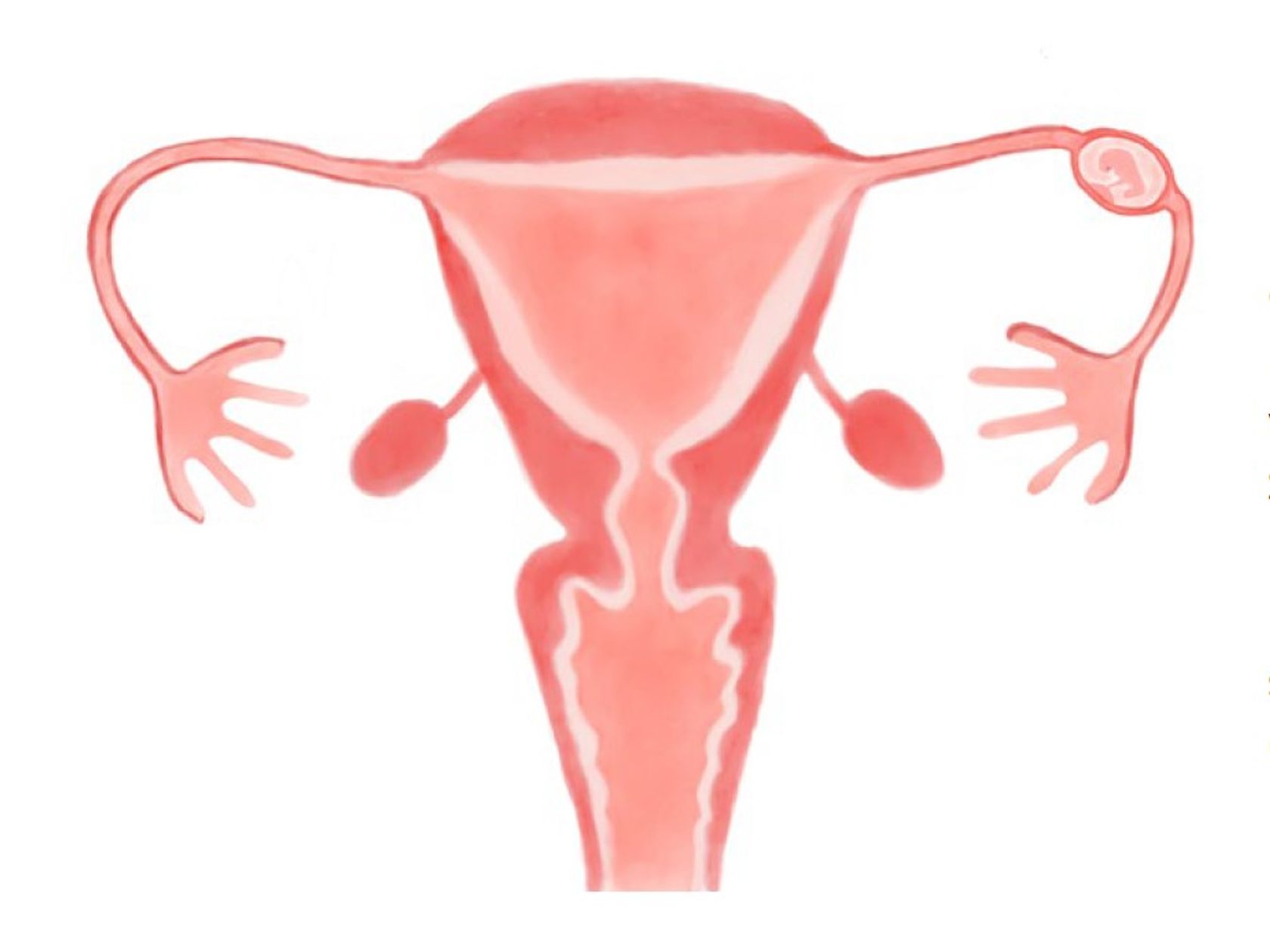 Illustration einer Eileiterschwangerschaft, der Embryo hat sich im Eileiter eingenistet.